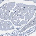 ASZ1 Antibody in Immunohistochemistry (IHC)