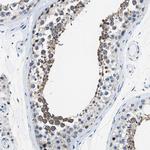 ASZ1 Antibody in Immunohistochemistry (Paraffin) (IHC (P))