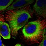 SERBP1 Polyclonal Antibody