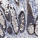 TBRG4 Antibody in Immunohistochemistry (Paraffin) (IHC (P))