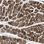 TBRG4 Antibody in Immunohistochemistry (Paraffin) (IHC (P))