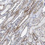 TBRG4 Antibody in Immunohistochemistry (Paraffin) (IHC (P))