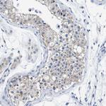 TBRG4 Antibody in Immunohistochemistry (Paraffin) (IHC (P))