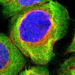 BAG3 Polyclonal Antibody