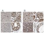 BAG3 Antibody in Immunohistochemistry (IHC)