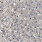 BAG3 Antibody in Immunohistochemistry (IHC)