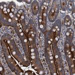 GULP1 Antibody in Immunohistochemistry (Paraffin) (IHC (P))
