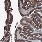 GOSR1 Antibody in Immunohistochemistry (Paraffin) (IHC (P))
