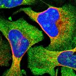 ZCCHC7 Polyclonal Antibody