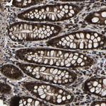 ZCCHC7 Antibody in Immunohistochemistry (Paraffin) (IHC (P))