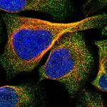 IPPK Polyclonal Antibody