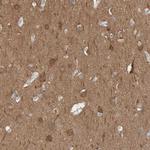 IPPK Antibody in Immunohistochemistry (Paraffin) (IHC (P))