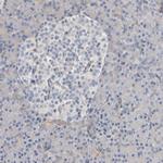IPPK Antibody in Immunohistochemistry (Paraffin) (IHC (P))