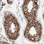 IPPK Antibody in Immunohistochemistry (Paraffin) (IHC (P))