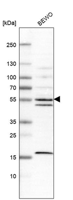 IPPK Antibody in Western Blot (WB)