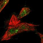 WDR60 Polyclonal Antibody