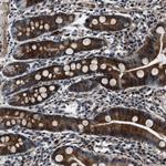 WDR60 Antibody in Immunohistochemistry (Paraffin) (IHC (P))