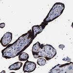 SVEP1 Polyclonal Antibody