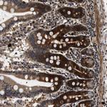 ZCCHC6 Polyclonal Antibody