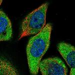 ZCCHC6 Polyclonal Antibody