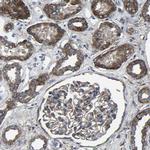KIAA1958 Antibody in Immunohistochemistry (IHC)