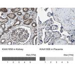 KIAA1958 Antibody