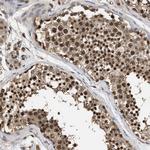 C9orf126 Antibody in Immunohistochemistry (Paraffin) (IHC (P))