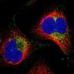 AASS Polyclonal Antibody