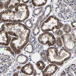 AASS Antibody in Immunohistochemistry (Paraffin) (IHC (P))