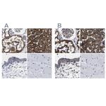 AASS Antibody in Immunohistochemistry (IHC)