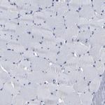 AASS Antibody in Immunohistochemistry (IHC)