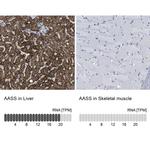 AASS Antibody