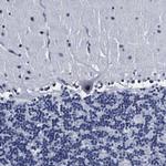 PRPF4B Antibody in Immunohistochemistry (Paraffin) (IHC (P))