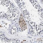 PRPF4B Antibody in Immunohistochemistry (Paraffin) (IHC (P))