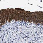 PRPF4B Antibody in Immunohistochemistry (Paraffin) (IHC (P))