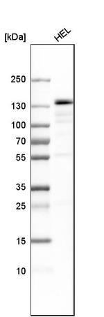 PRPF4B Antibody in Western Blot (WB)