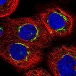 ZMYND19 Polyclonal Antibody