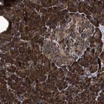 ZMYND19 Antibody in Immunohistochemistry (Paraffin) (IHC (P))