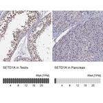 SETD1A Antibody