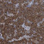 TEX2 Antibody in Immunohistochemistry (Paraffin) (IHC (P))