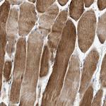 TEX2 Antibody in Immunohistochemistry (Paraffin) (IHC (P))