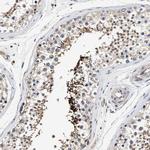 TEX2 Antibody in Immunohistochemistry (Paraffin) (IHC (P))
