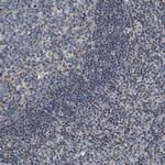 TEX2 Polyclonal Antibody