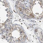 NSUN7 Antibody in Immunohistochemistry (Paraffin) (IHC (P))