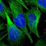 CI016 Polyclonal Antibody