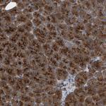 CI016 Antibody in Immunohistochemistry (Paraffin) (IHC (P))