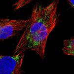 AASS Polyclonal Antibody