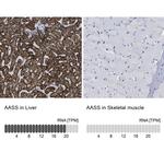 AASS Antibody in Immunohistochemistry (IHC)