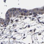 AASS Antibody in Immunohistochemistry (IHC)