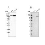 AASS Antibody in Western Blot (WB)
